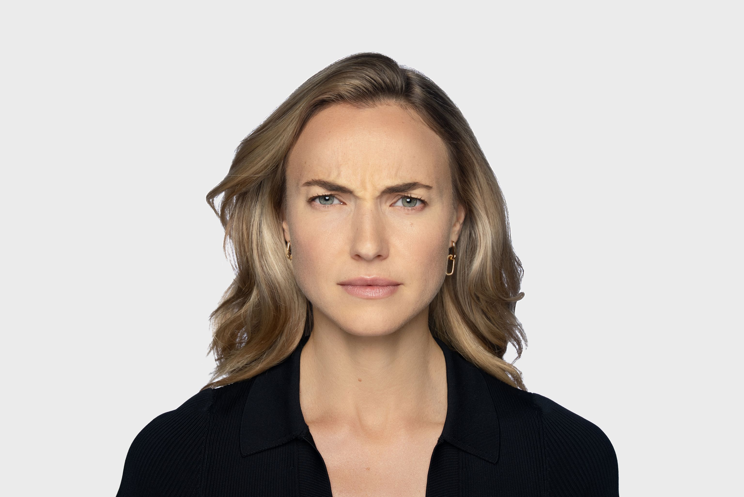 Patient before DAXXIFY treatment, frowning